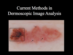 Dermoscopic Image Analysis